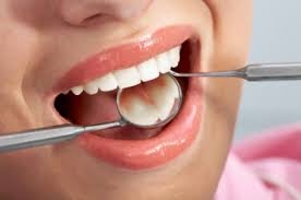 Зъболекари - хората, които се грижат за нашето орално здраве.