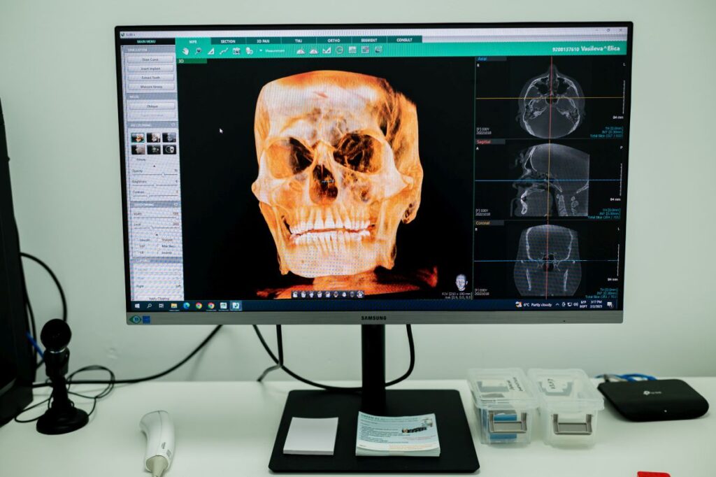 Рентгенова секторна, ОПГ и 3D диагностика