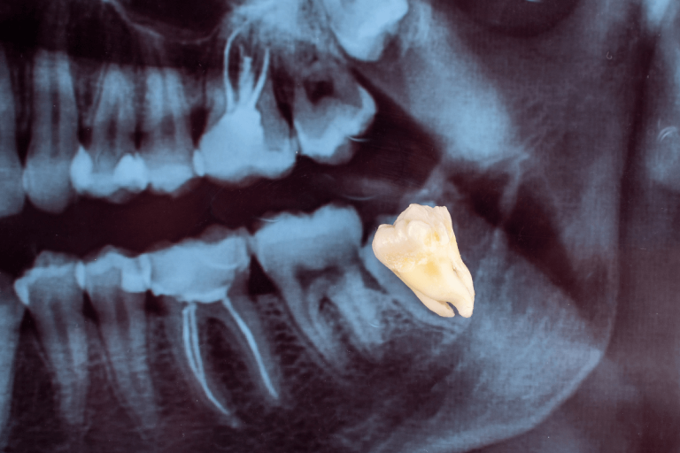 Какво представлява мъдреца