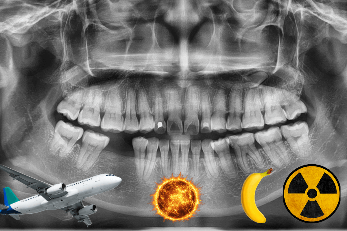 Дентални рентгенови снимки- всичко, което трябва да знаете