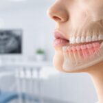 Обратна захапка - причини, последици и видове лечение